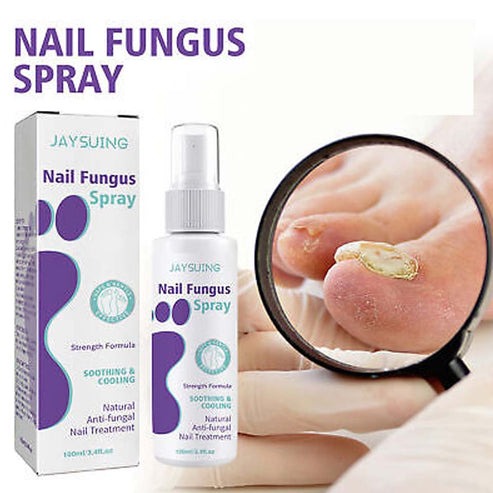 Nail Fungus™ Spray anti hongos para uñas 100ml.